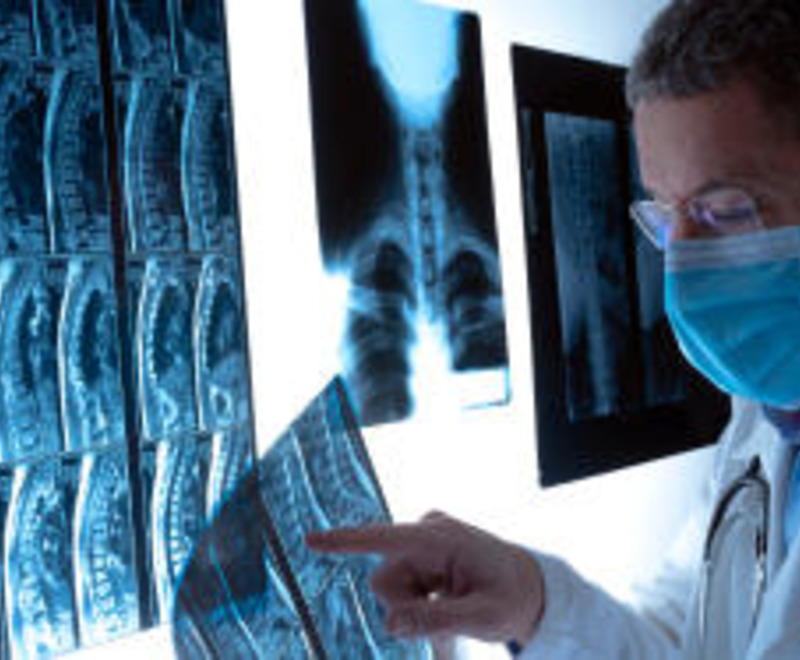 Разница между КТ и рентгенографией